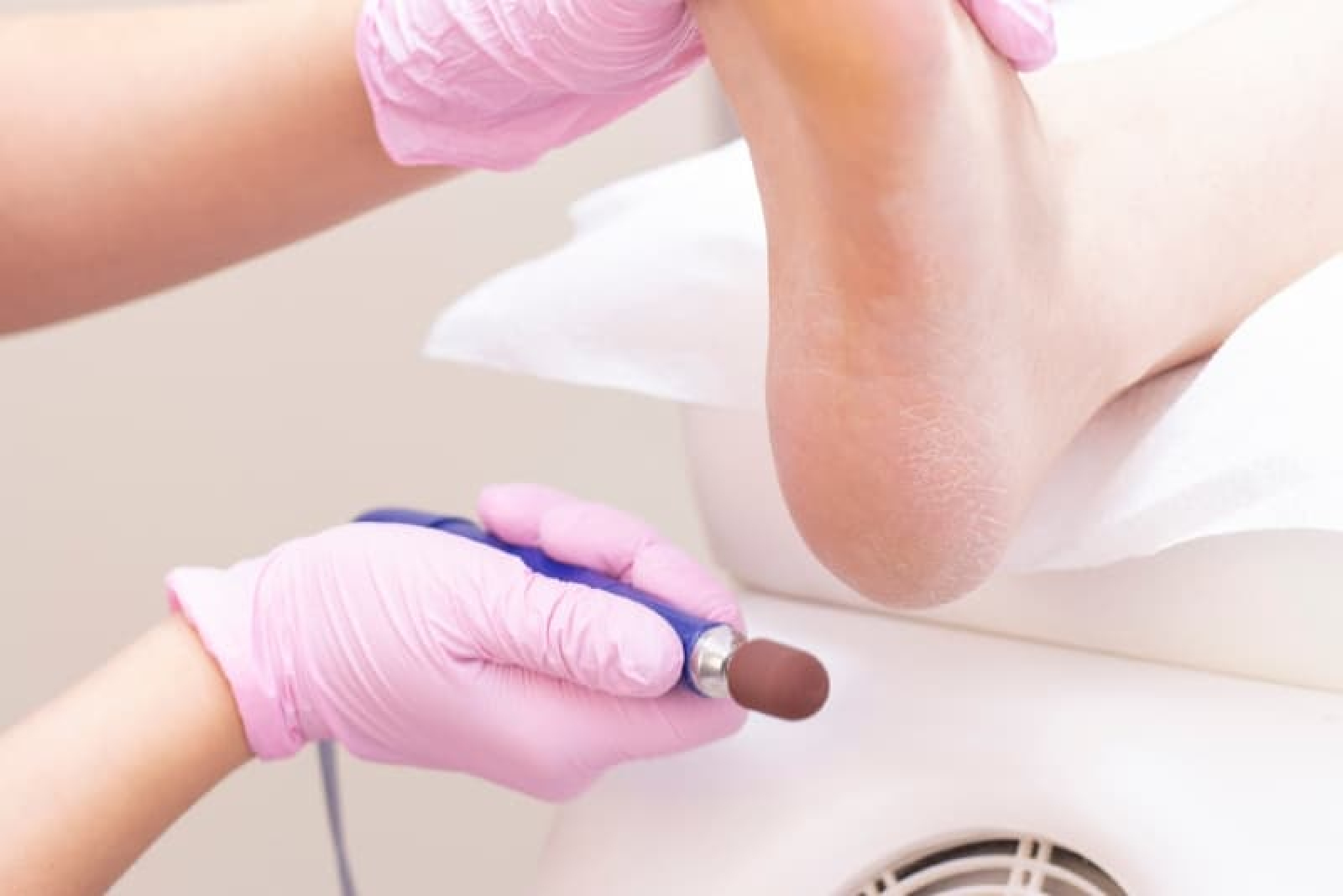 Chuyên Gia Phục Hồi Gót Chân