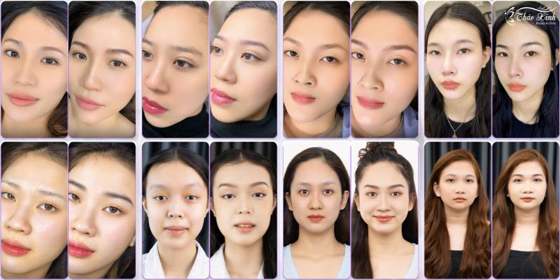 Hình ảnh trước và sau khi điêu khắc chân mày tại Thảo Xinh – kỹ thuật tạo sợi tự nhiên, mực organic an toàn, dáng mày được đo theo tỉ lệ vàng gương mặt.
