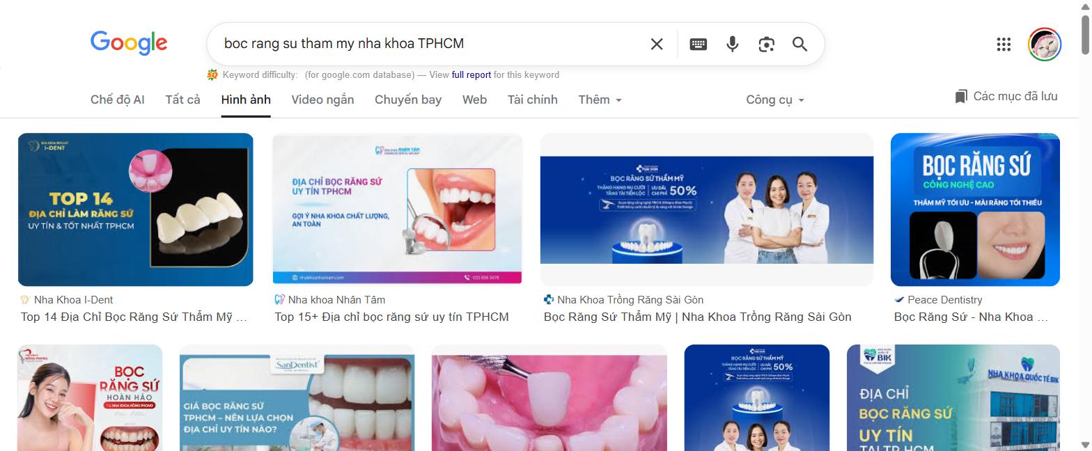 Địa chỉ bọc răng sứ thẩm mỹ uy tín tại TPHCM 2026