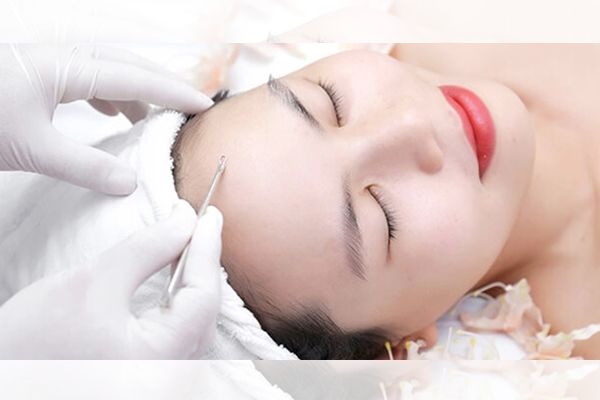 Các bước spa hỗ trợ điều trị mụn tận gốc