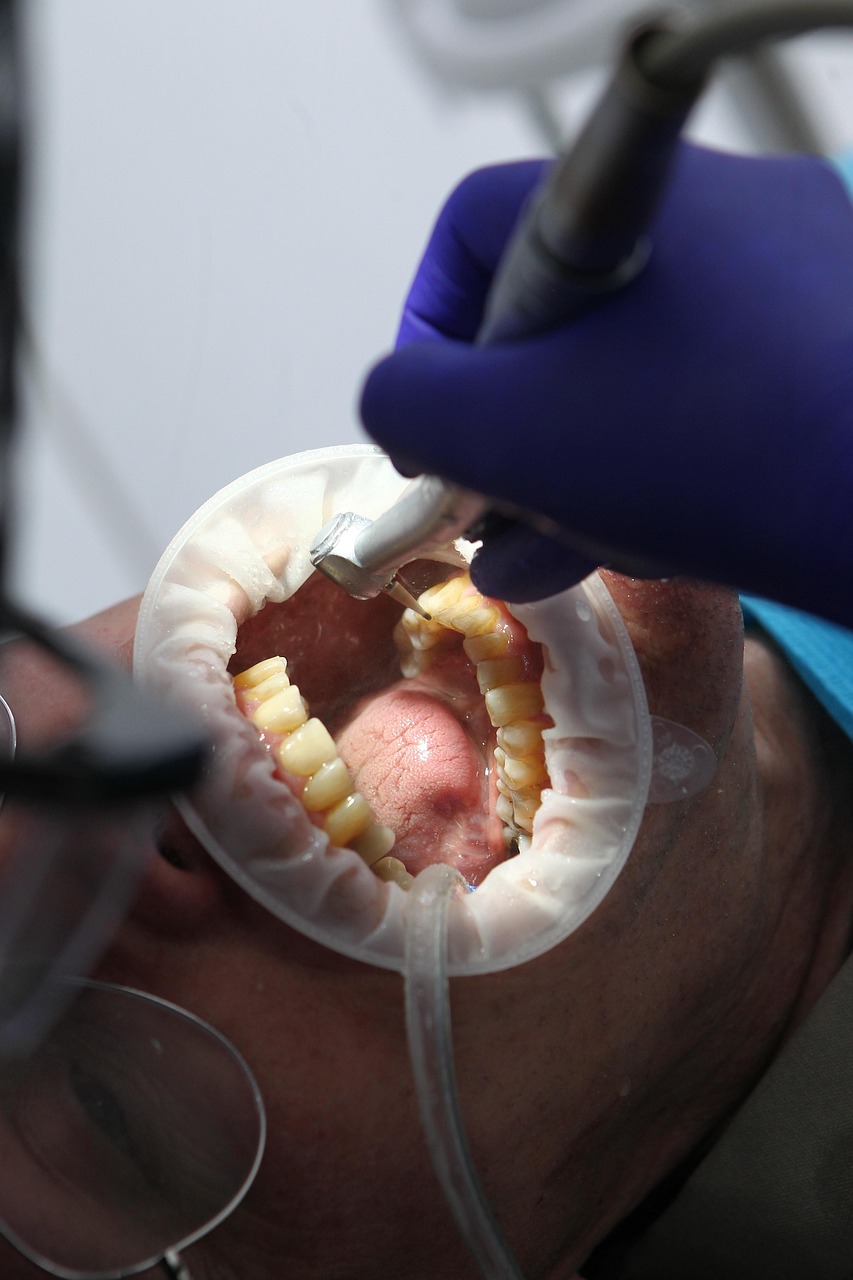 điều trị răng hàm mặt TPHCM