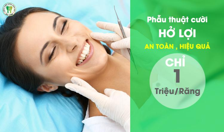 Địa chỉ cắt lợi uy tín Bệnh Viện Răng Hàm Mặt Sài Gòn với kết quả thẩm mỹ rõ rệt.