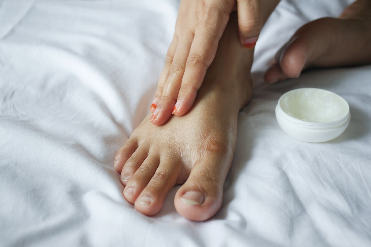 Thoa kem trị nứt nẻ gót chân lên vùng da khô mỗi tối